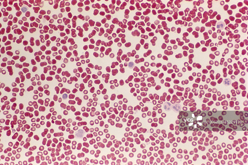 血细胞显微照片图片素材