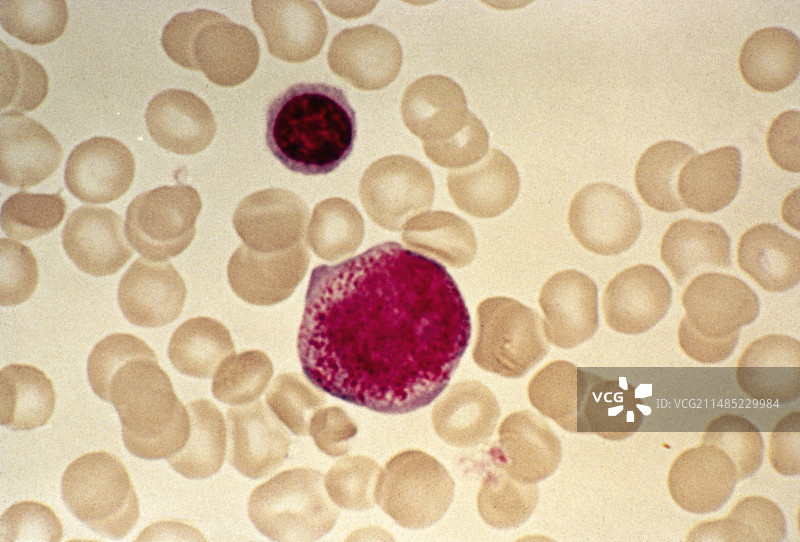 髓母细胞光学显微照片图片素材