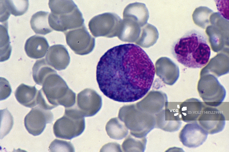 成红细胞，光学显微照片图片素材
