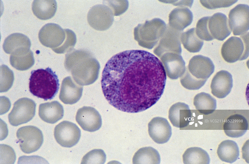 早幼粒细胞血细胞显微照片图片素材