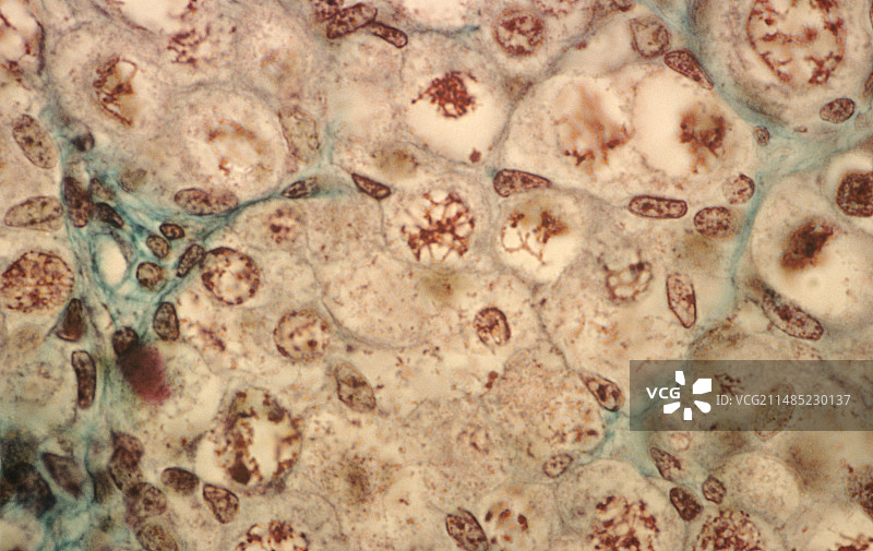 胎儿卵巢组织显微照片图片素材