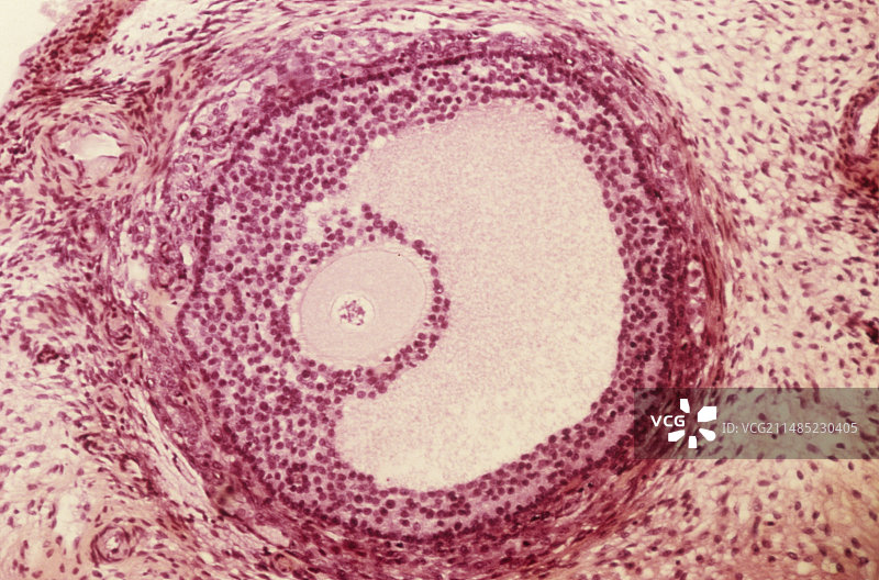 卵泡，光学显微照片图片素材