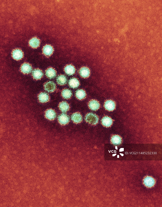 诺如病毒颗粒（透射电子显微镜）图片素材