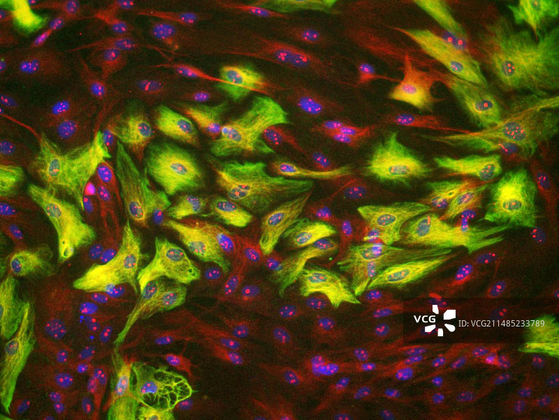 星形胶质细胞脑细胞显微照片图片素材