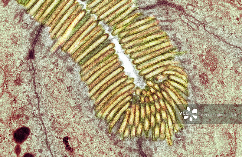 肠刷状缘（透射电镜）图片素材