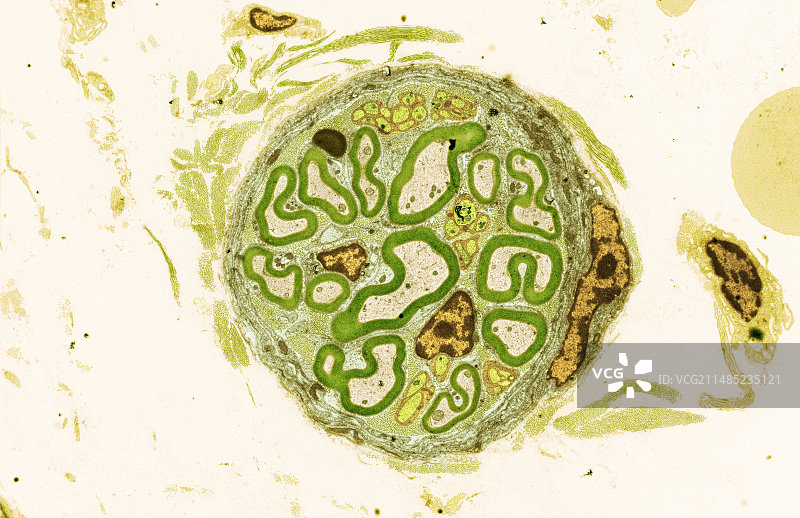 髓鞘神经TEM图片素材
