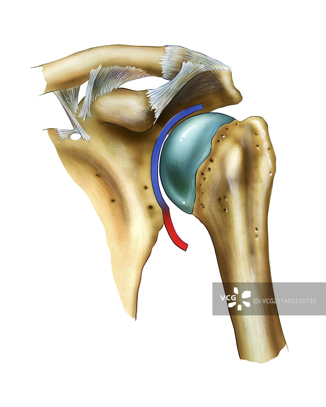 肩关节囊感染医学插画图片素材