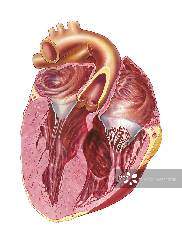心脏室壁缺损医疗插画图片素材