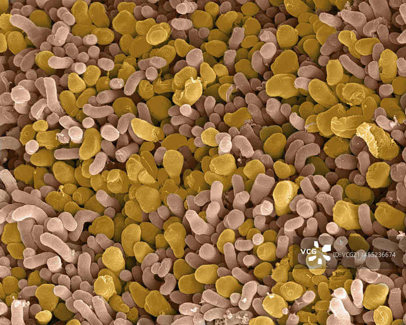 眼睛的视杆和视锥细胞，扫描电镜图片素材