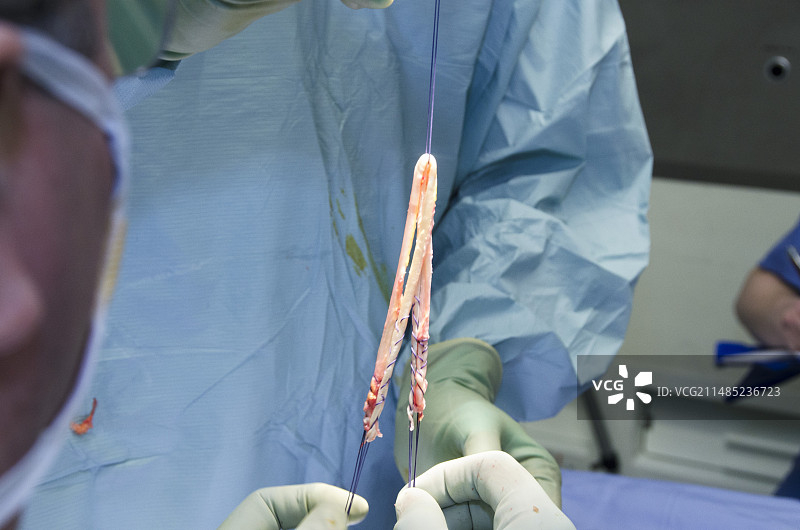 膝关节韧带重建手术图片素材