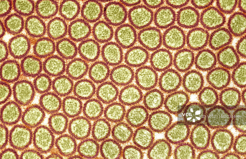 肠道微绒毛扫描电镜图图片素材