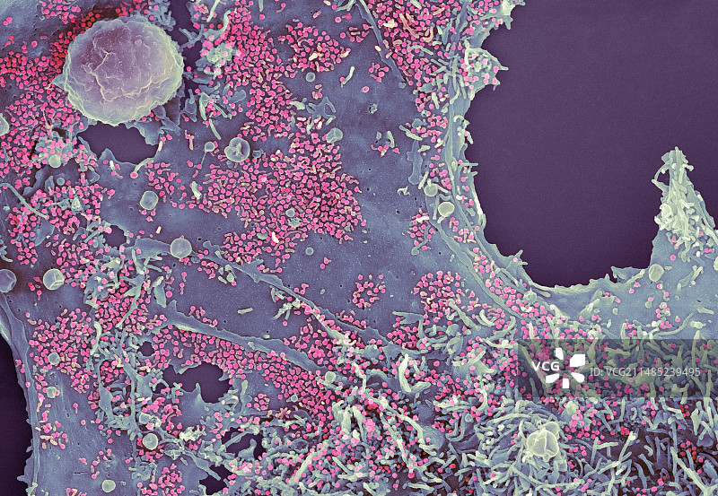 感染疱疹病毒的细胞（扫描电镜图）图片素材