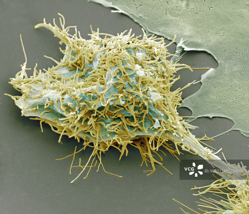 脑癌细胞分裂（扫描电镜）图片素材