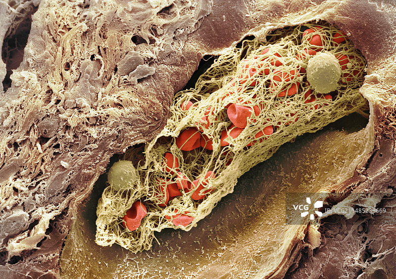 血栓扫描电镜图片素材
