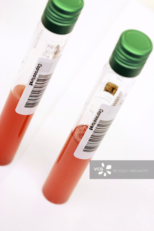 粪便样本图片素材