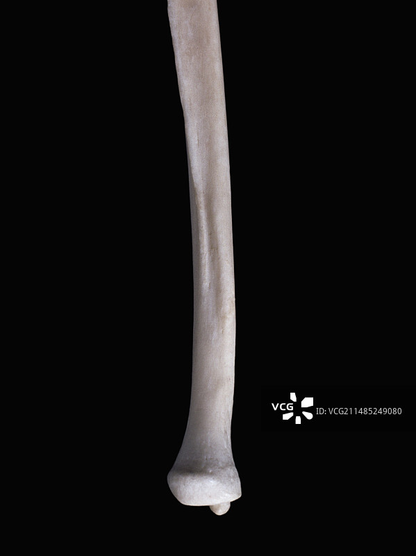 右尺骨图片素材