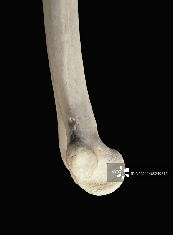 左肱骨远端图片素材