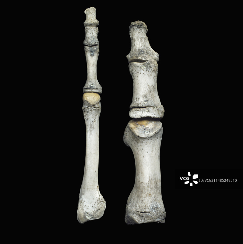 第二脚趾的跖骨和趾骨图片素材