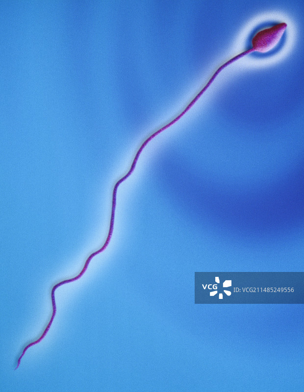 人类精子扫描电镜X2250图片素材