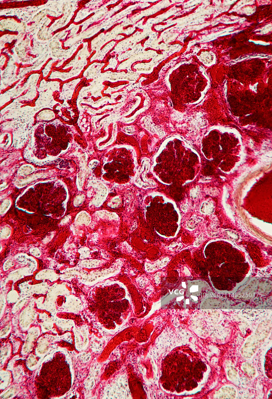 肾脏显微照片图片素材