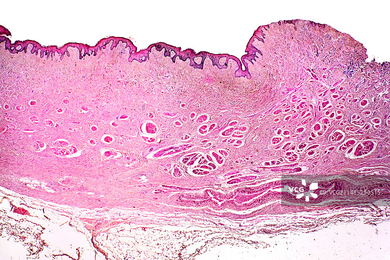 皮肤，光学显微照片图片素材