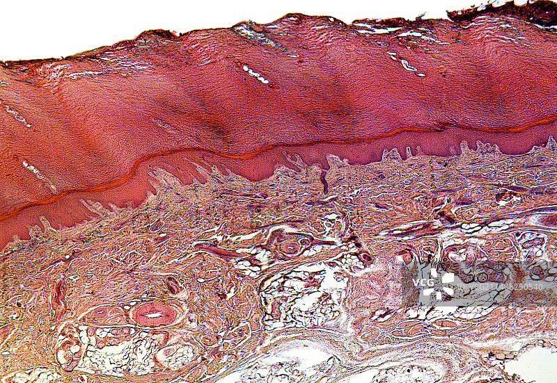 足底浅显微照片图片素材