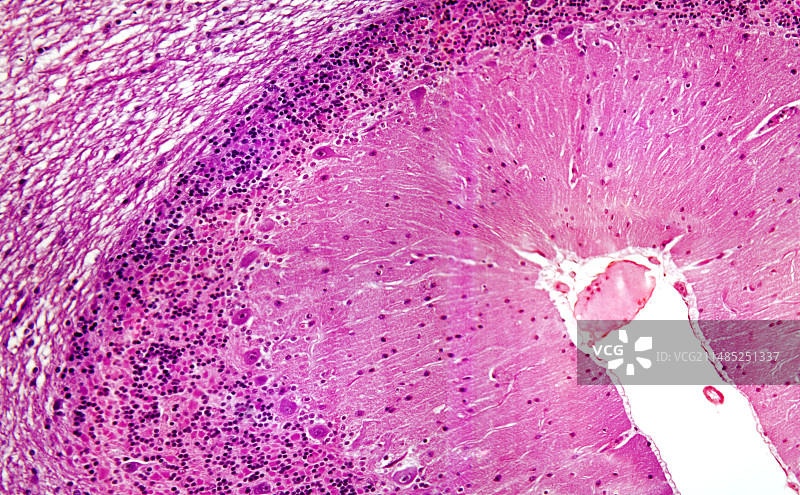 小脑显微照片图片素材