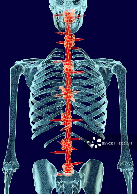 背痛，概念艺术作品图片素材