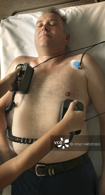 心脏病发作患者的复苏图片素材