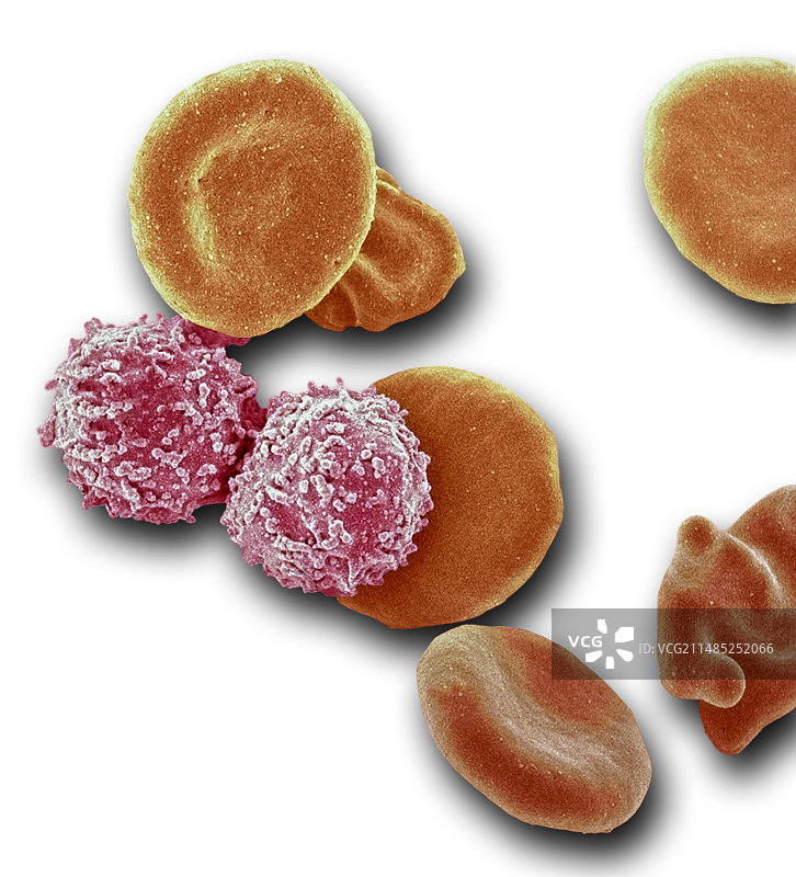 白血病血细胞图片素材