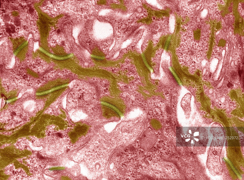 皮肤细胞桥粒的透射电子显微镜图片素材