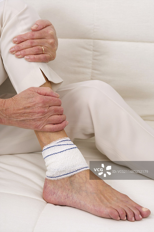 踝关节扭伤图片素材
