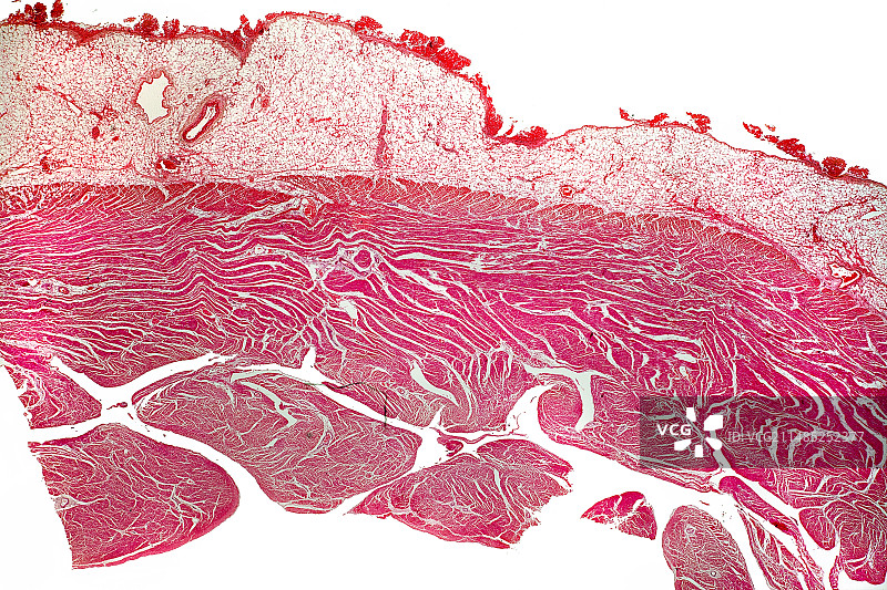 心包炎显微照片图片素材