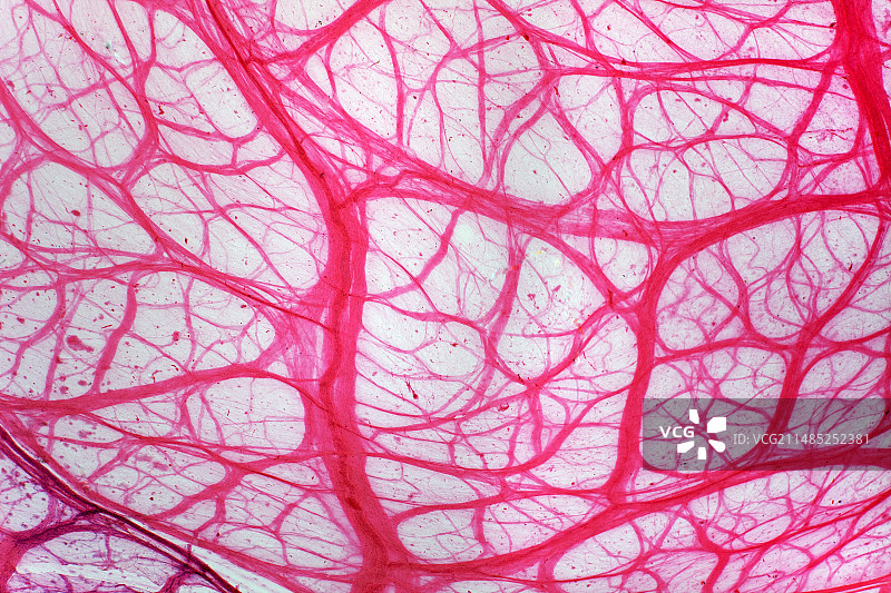 膀胱组织显微照片图片素材