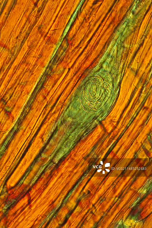 线虫幼虫囊肿显微照片图片素材