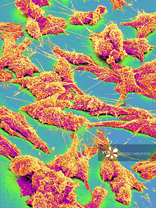 癌细胞（扫描电镜图）图片素材