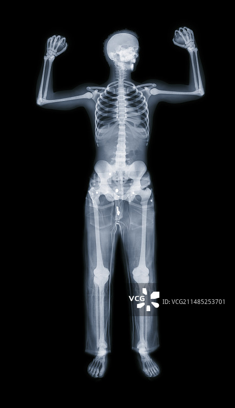 拳击姿势X光片图片素材