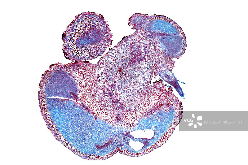 羽扇豆根瘤，光学显微照片图片素材