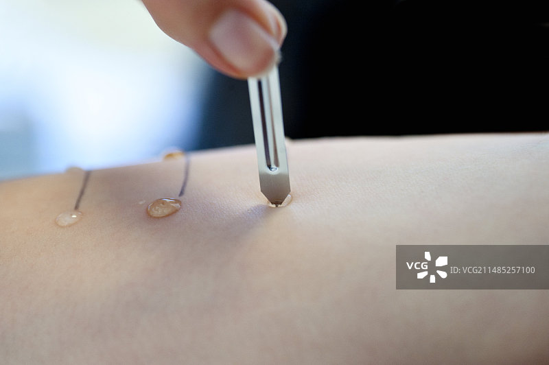 皮肤过敏测试图片素材