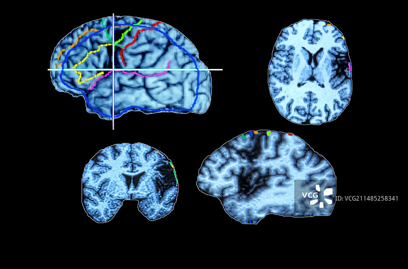 CT扫描图片素材