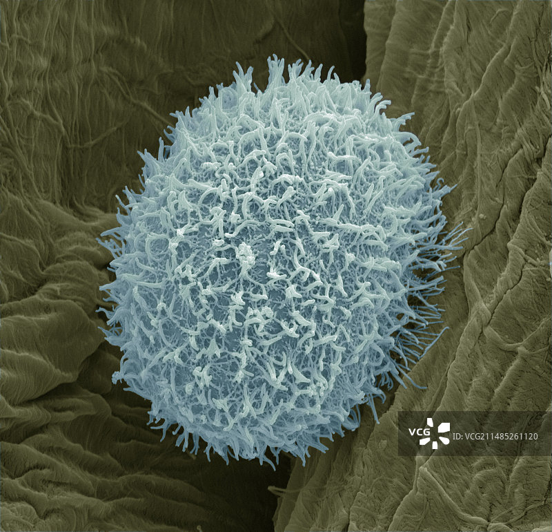 纤毛原生动物扫描电镜图图片素材