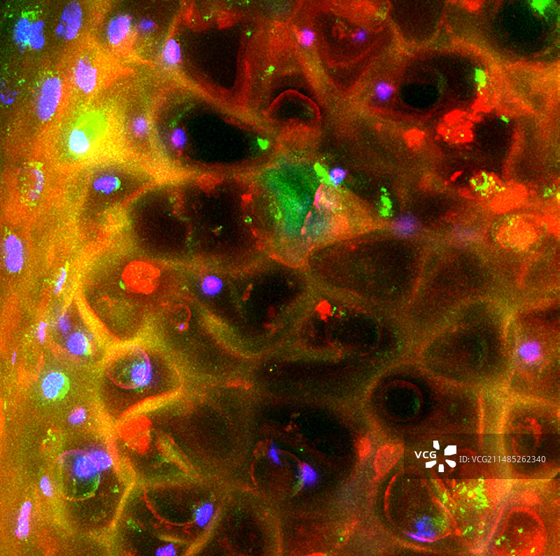 喉咙组织荧光显微照片图片素材