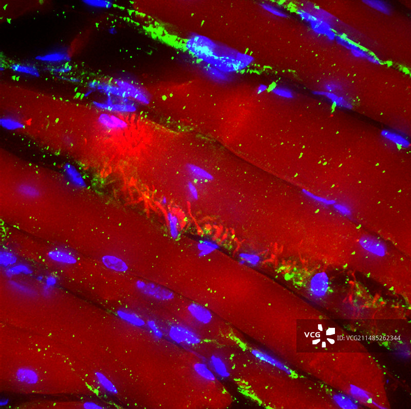 喉咙组织荧光显微照片图片素材