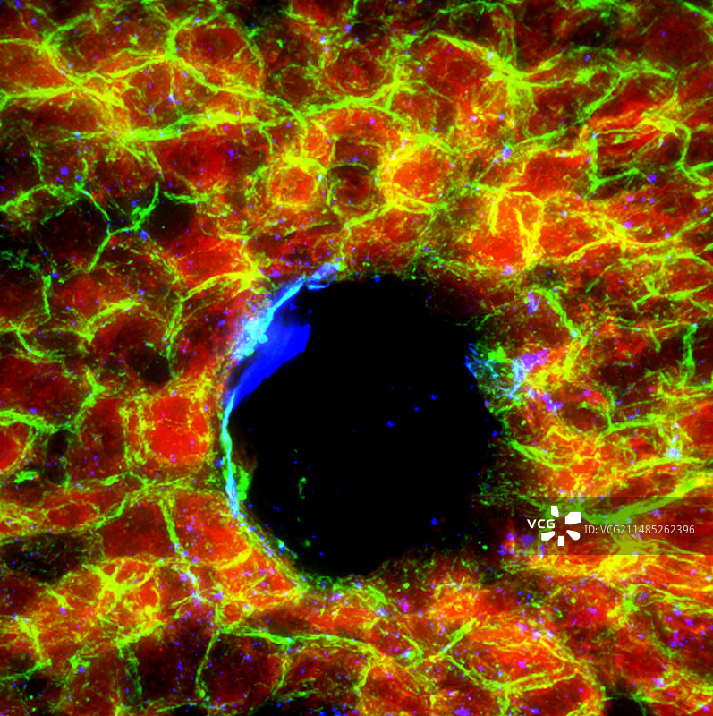 肝脏组织荧光显微照片图片素材