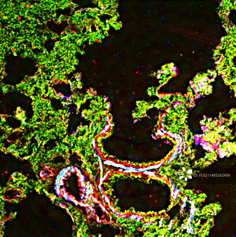 肺组织，荧光显微照片图片素材