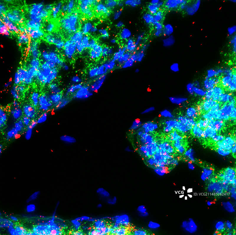 肺组织,荧光显微照片图片素材