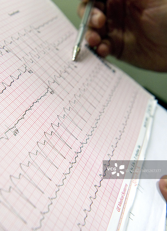 心电图分析图片素材