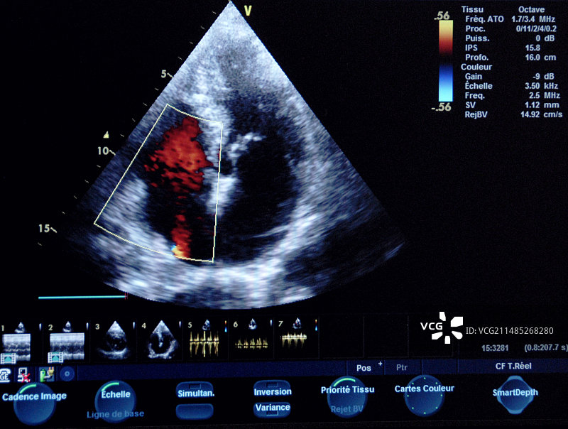 心脏超声波扫描图片素材
