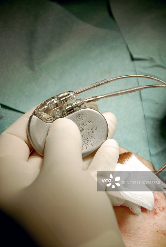 心脏起搏器手术图片素材