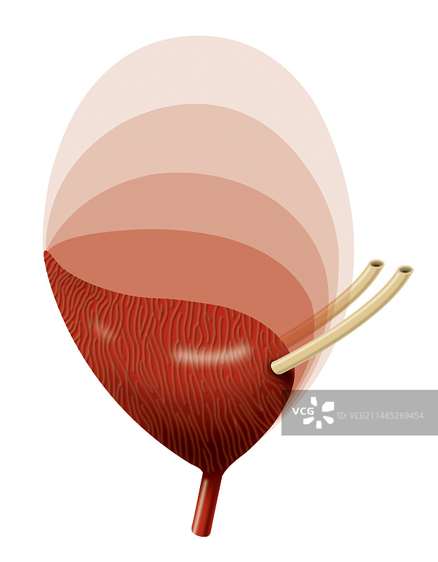 膀胱扩张艺术作品图片素材